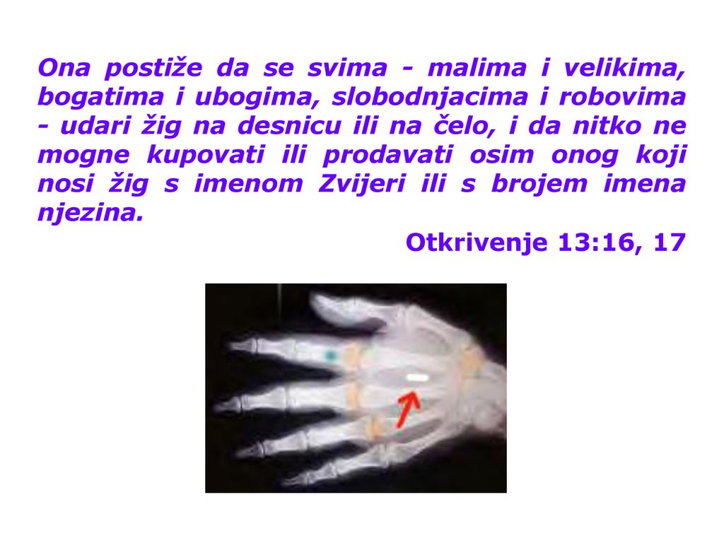 Ona postiže da se svima - malima i velikima, bogatima i ubogima, slobodnjacima i robovima - udari žig na desnicu ili na čelo, i da nitko ne mogne kupovati ili prodavati osim onog koji nosi žig s imenom Zvijeri ili s brojem imena njezina.
