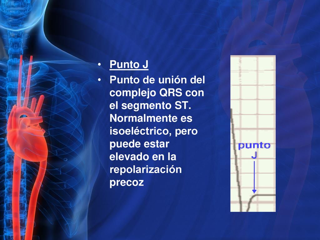 Punto J Punto de unión del complejo QRS con el segmento ST.