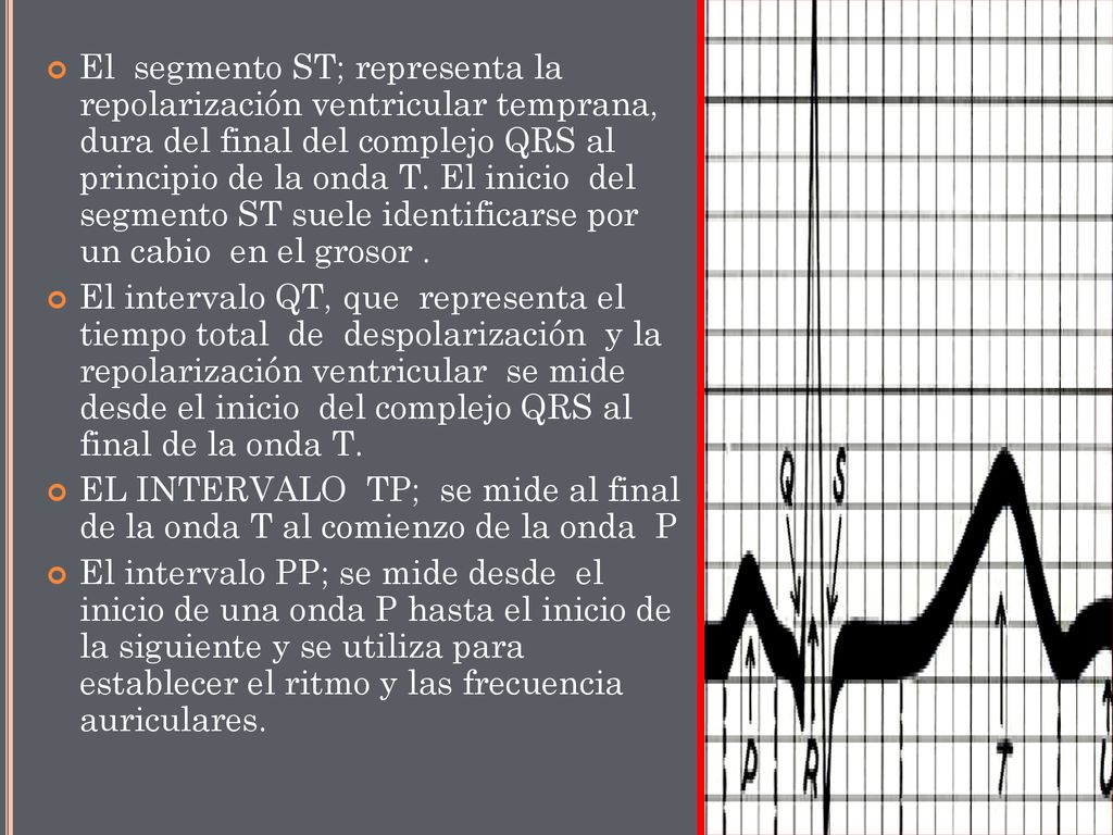 El segmento ST; representa la repolarización ventricular temprana, dura del final del complejo QRS al principio de la onda T. El inicio del segmento ST suele identificarse por un cabio en el grosor .