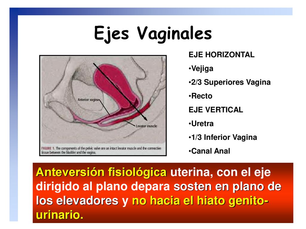Ejes Vaginales EJE HORIZONTAL. Vejiga. 2/3 Superiores Vagina. Recto. EJE VERTICAL. Uretra. 1/3 Inferior Vagina.