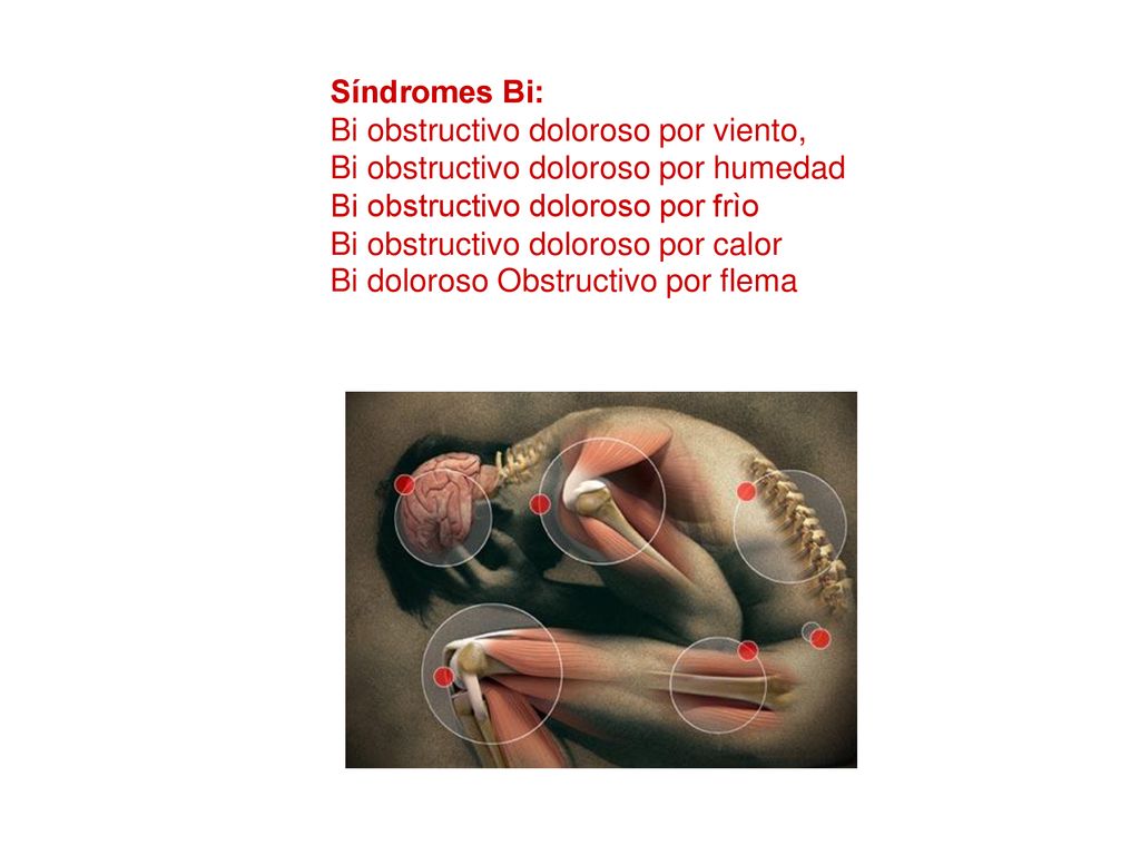 Síndromes Bi: Bi obstructivo doloroso por viento, Bi obstructivo doloroso por humedad. Bi obstructivo doloroso por frìo.