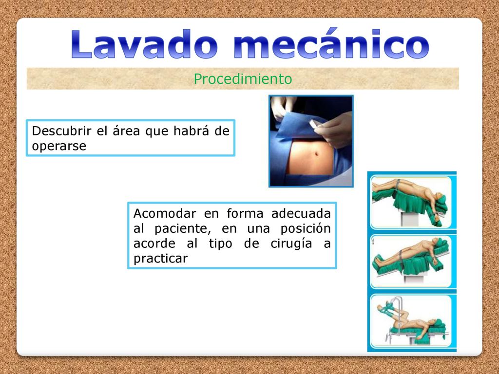 Lavado mecánico Procedimiento Descubrir el área que habrá de operarse