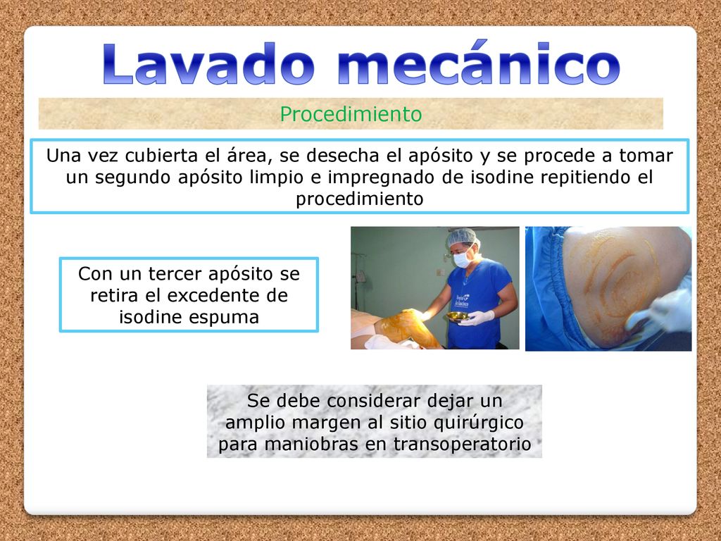 Con un tercer apósito se retira el excedente de isodine espuma