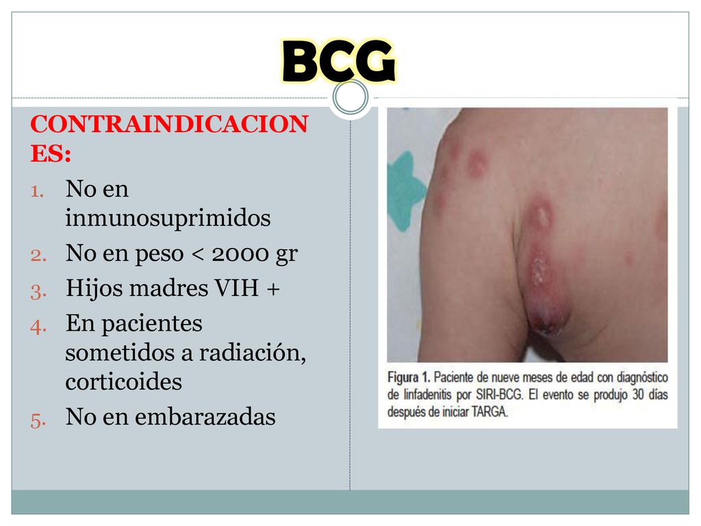 BCG CONTRAINDICACIONES: No en inmunosuprimidos No en peso < 2000 gr