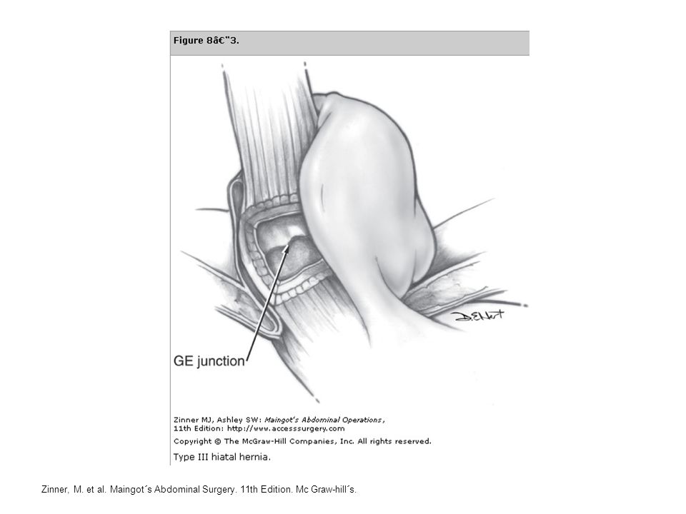 Zinner, M. et al. Maingot´s Abdominal Surgery. 11th Edition