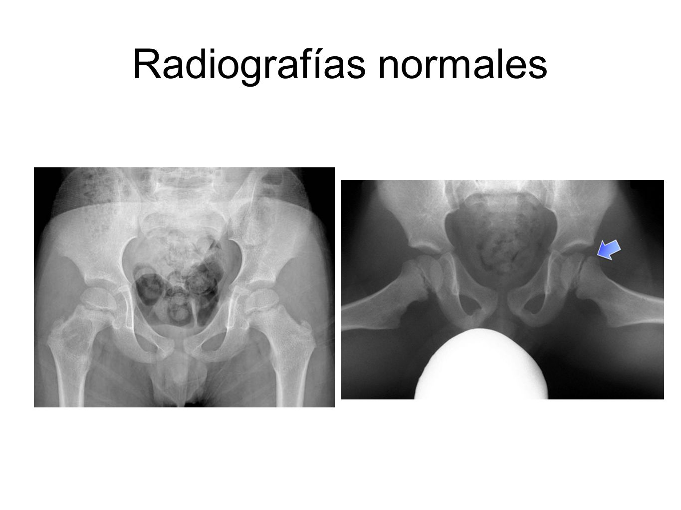 Radiografías normales