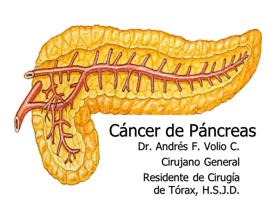 Cáncer de Páncreas Dr. Andrés F. Volio C. Cirujano General