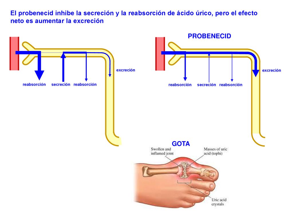 El probenecid inhibe la secreción y la reabsorción de ácido úrico, pero el efecto neto es aumentar la excreción