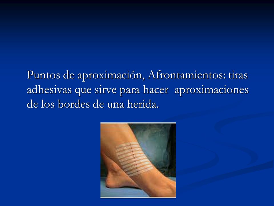 Puntos de aproximación, Afrontamientos: tiras adhesivas que sirve para hacer aproximaciones de los bordes de una herida.