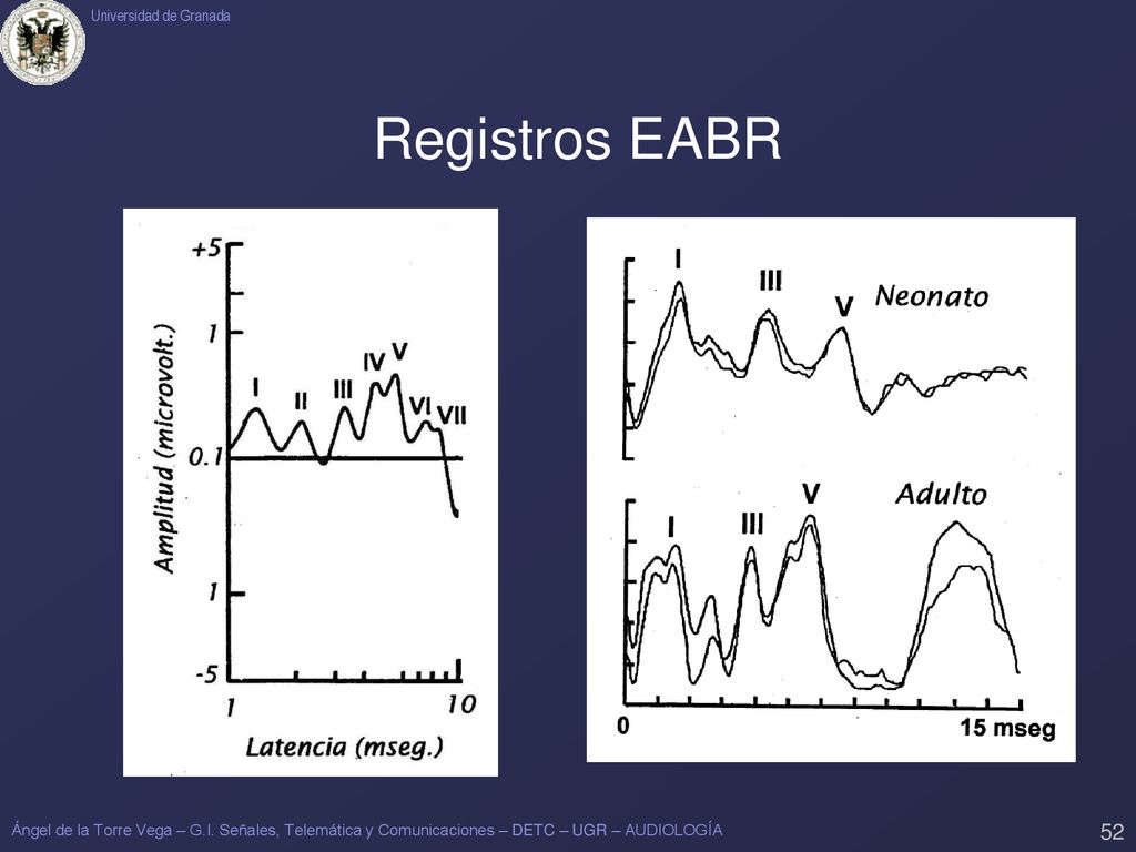 Registros EABR Ángel de la Torre Vega – G.I.