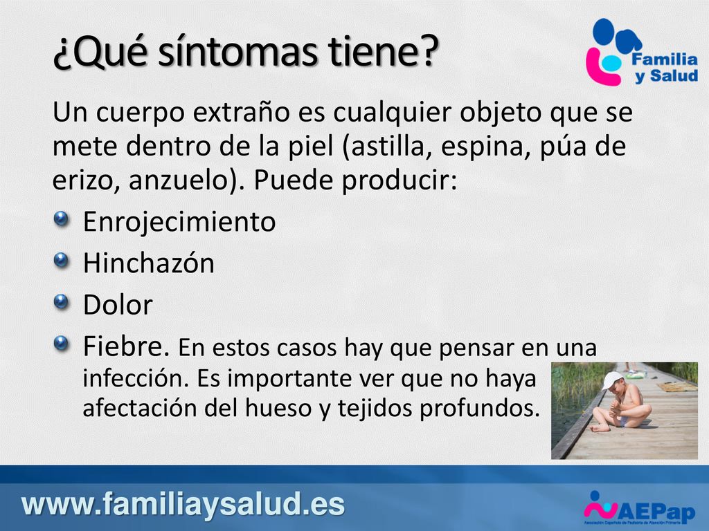 ¿Qué síntomas tiene Un cuerpo extraño es cualquier objeto que se mete dentro de la piel (astilla, espina, púa de erizo, anzuelo). Puede producir: