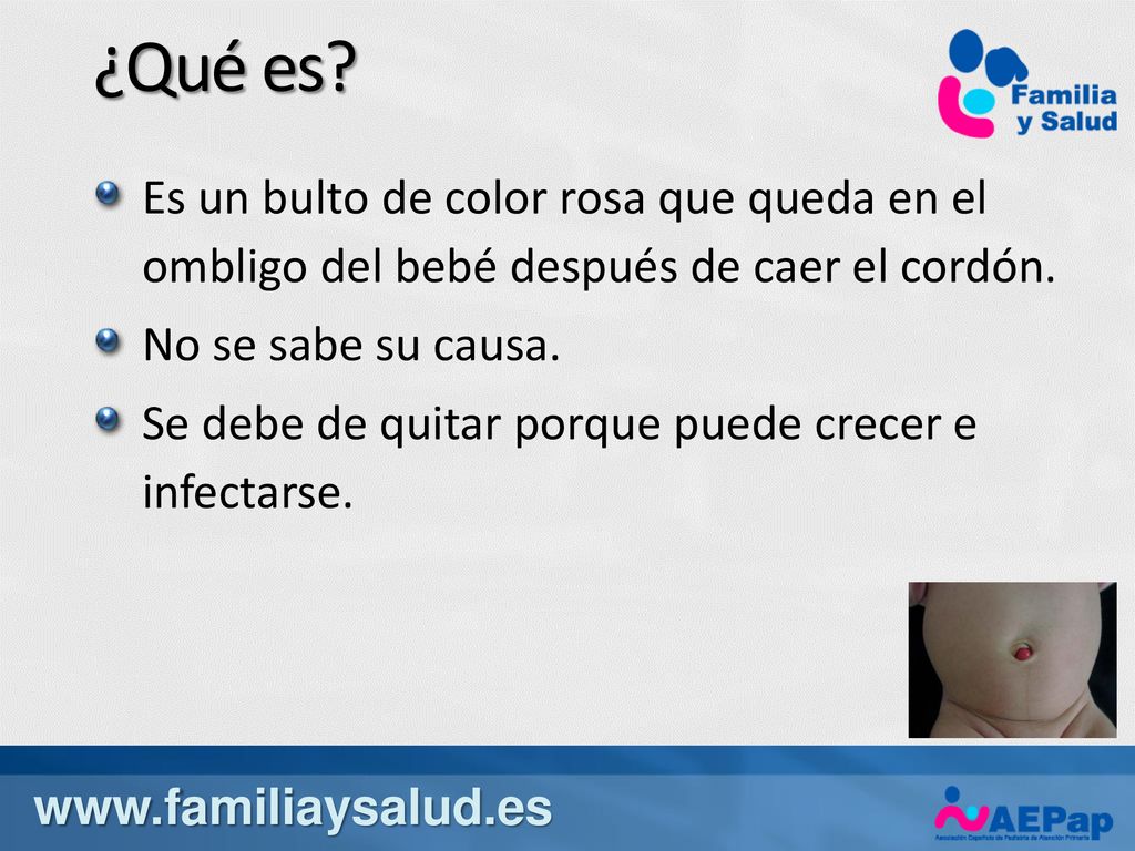 ¿Qué es Es un bulto de color rosa que queda en el ombligo del bebé después de caer el cordón. No se sabe su causa.