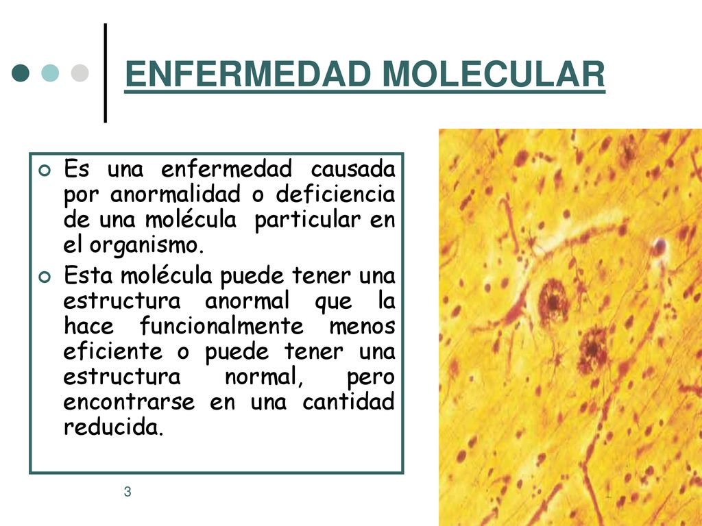 ENFERMEDAD MOLECULAR Es una enfermedad causada por anormalidad o deficiencia de una molécula particular en el organismo.
