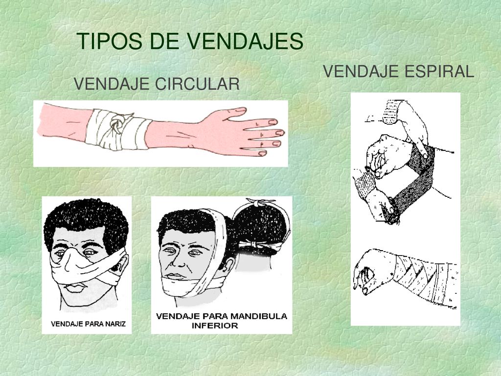 TIPOS DE VENDAJES VENDAJE ESPIRAL VENDAJE CIRCULAR