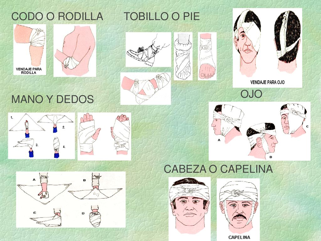 CODO O RODILLA TOBILLO O PIE OJO MANO Y DEDOS CABEZA O CAPELINA