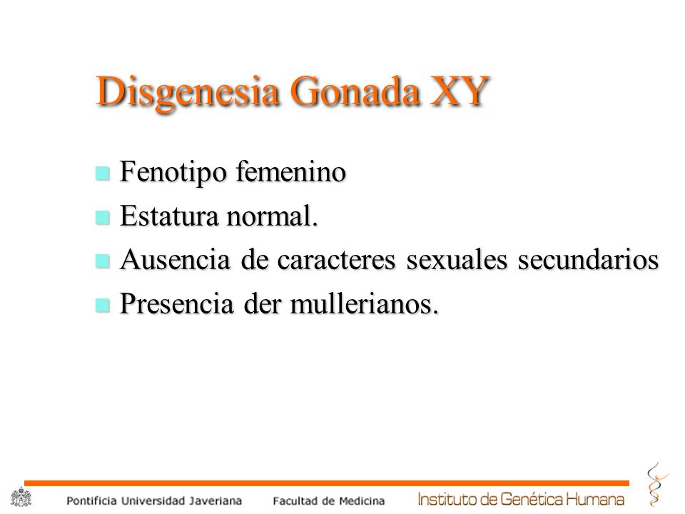 Disgenesia Gonada XY Fenotipo femenino Estatura normal.