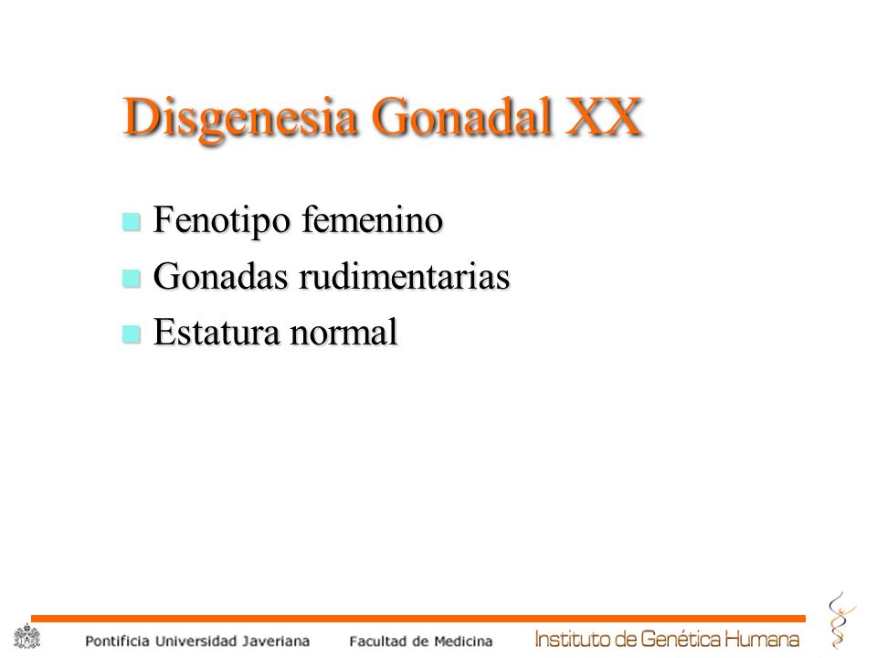 Disgenesia Gonadal XX Fenotipo femenino Gonadas rudimentarias