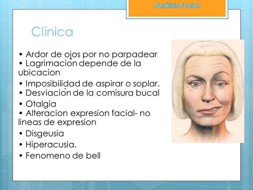 Parálisis Facial Clinica. • Ardor de ojos por no parpadear • Lagrimación depende de la ubicacion.