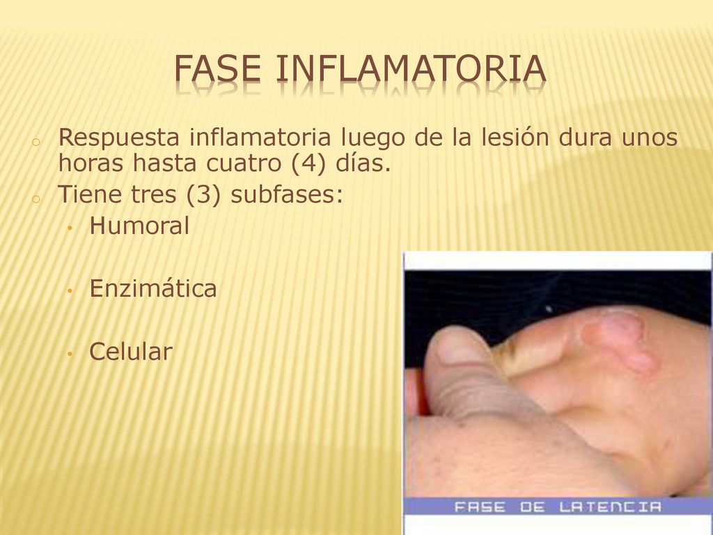 Fase Inflamatoria Respuesta inflamatoria luego de la lesión dura unos horas hasta cuatro (4) días. Tiene tres (3) subfases: