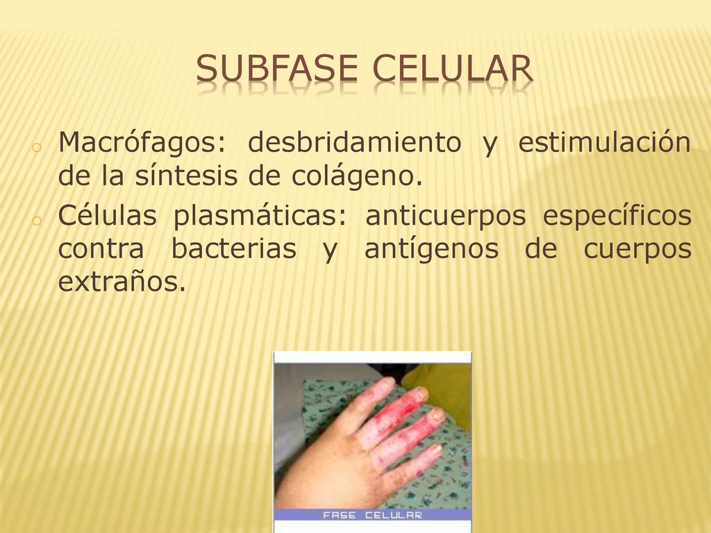 Subfase Celular Macrófagos: desbridamiento y estimulación de la síntesis de colágeno.