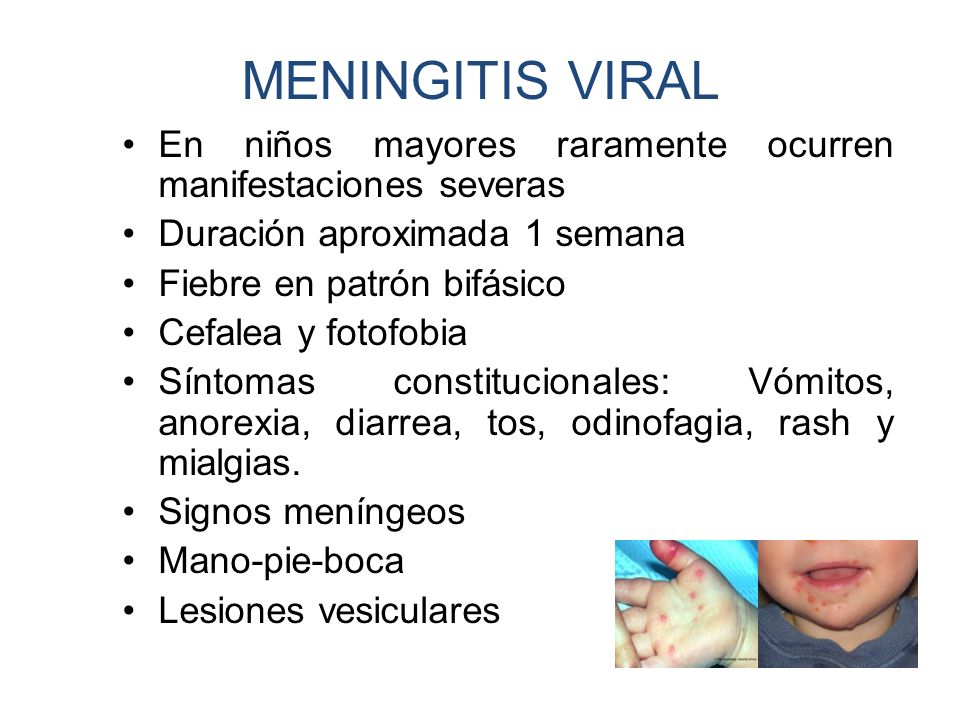 MENINGITIS VIRAL En niños mayores raramente ocurren manifestaciones severas. Duración aproximada 1 semana.