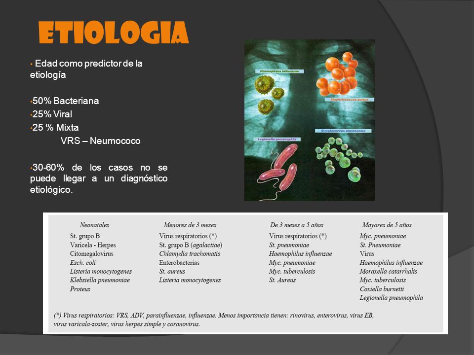 ETIOLOGIA Edad como predictor de la etiología 50% Bacteriana 25% Viral