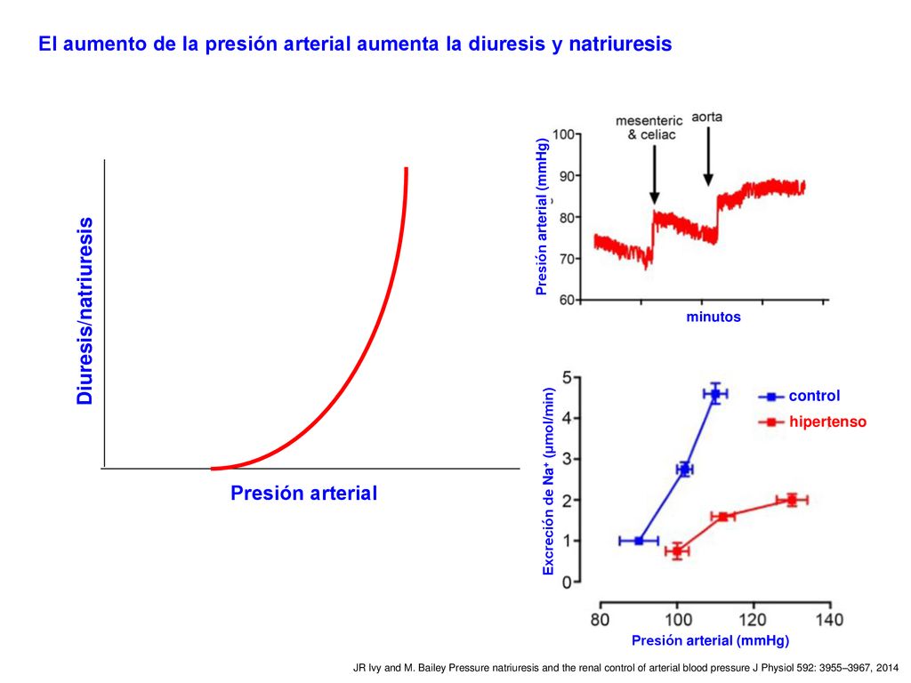El aumento de la presión arterial aumenta la diuresis y natriuresis