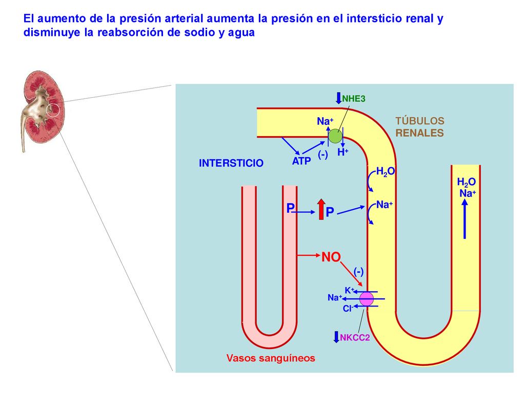 El aumento de la presión arterial aumenta la presión en el intersticio renal y disminuye la reabsorción de sodio y agua