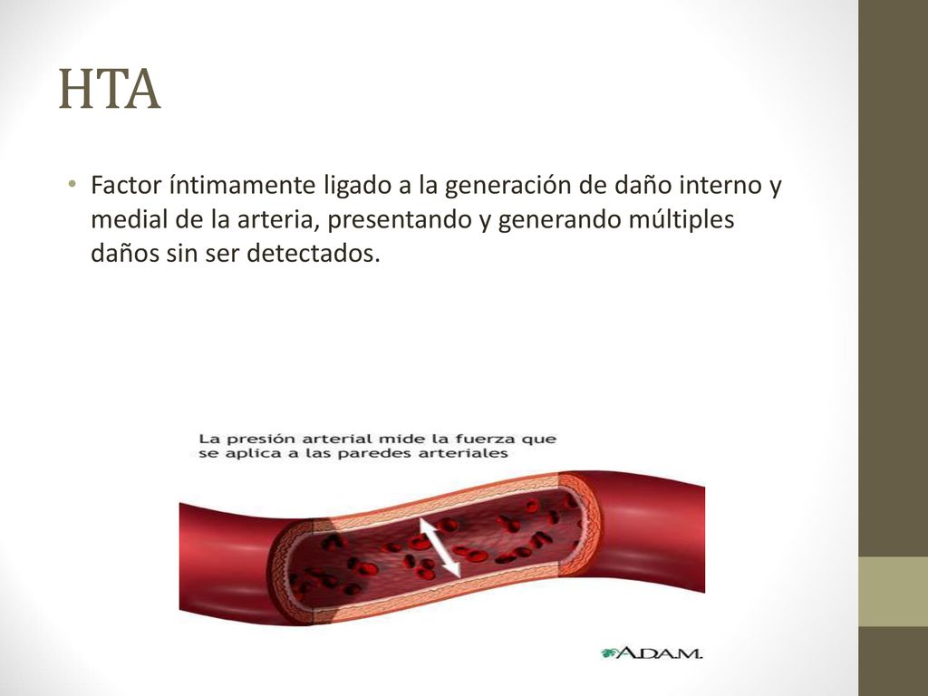 HTA Factor íntimamente ligado a la generación de daño interno y medial de la arteria, presentando y generando múltiples daños sin ser detectados.