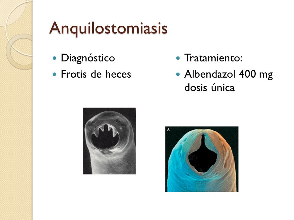 Anquilostomiasis Diagnóstico Frotis de heces Tratamiento: