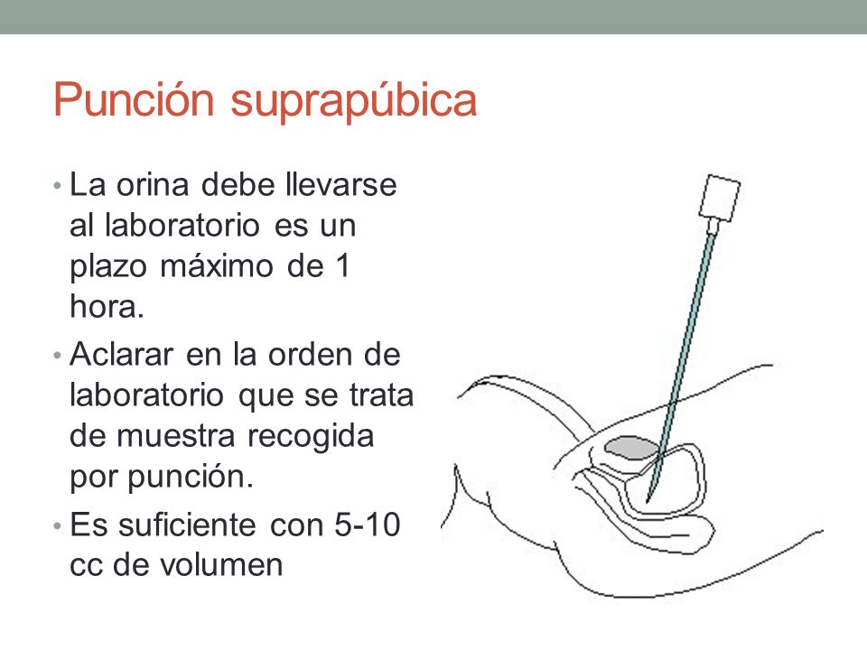 Punción suprapúbica La orina debe llevarse al laboratorio es un plazo máximo de 1 hora.