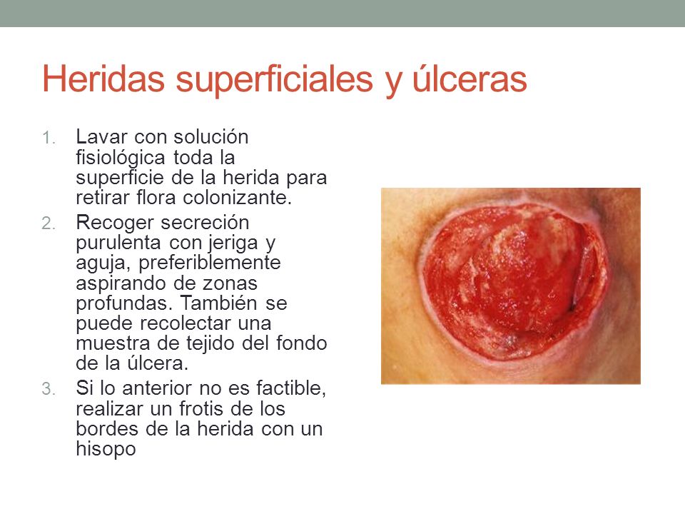 Heridas superficiales y úlceras