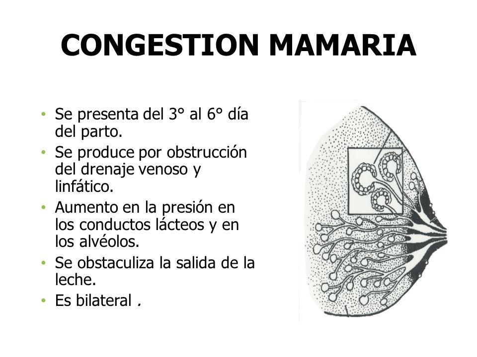 CONGESTION MAMARIA Se presenta del 3° al 6° día del parto.