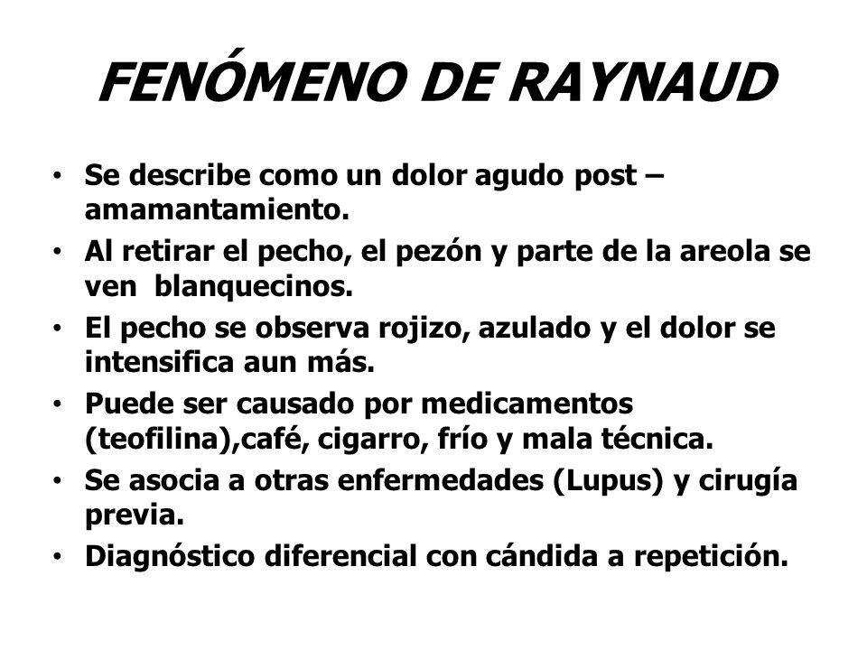 FENÓMENO DE RAYNAUD Se describe como un dolor agudo post – amamantamiento. Al retirar el pecho, el pezón y parte de la areola se ven blanquecinos.