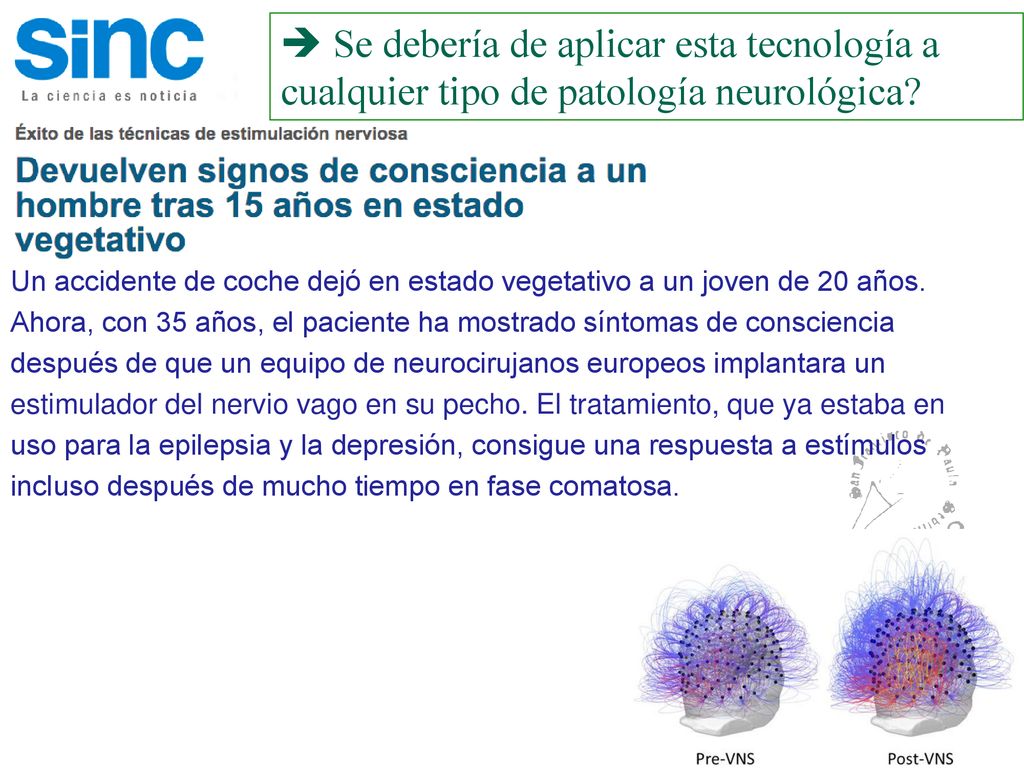  Se debería de aplicar esta tecnología a cualquier tipo de patología neurológica