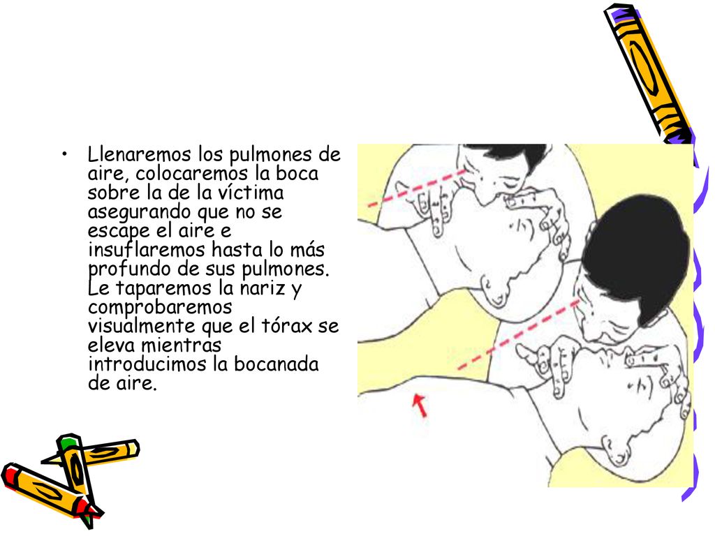 Llenaremos los pulmones de aire, colocaremos la boca sobre la de la víctima asegurando que no se escape el aire e insuflaremos hasta lo más profundo de sus pulmones.