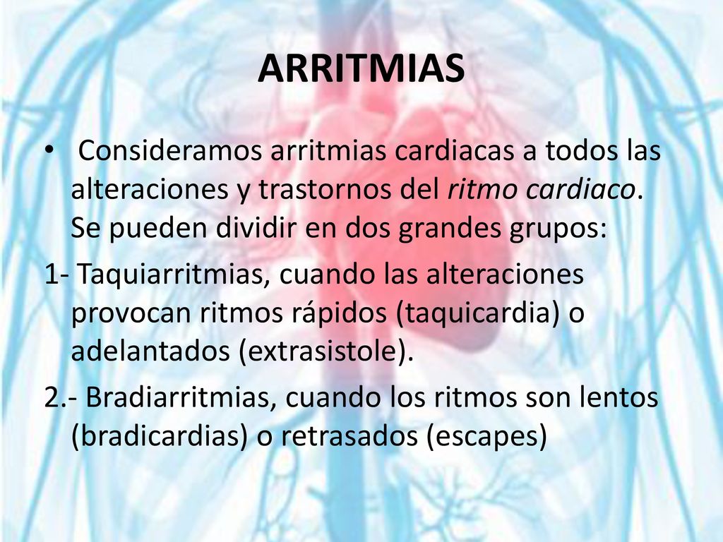 ARRITMIAS Consideramos arritmias cardiacas a todos las alteraciones y trastornos del ritmo cardiaco. Se pueden dividir en dos grandes grupos: