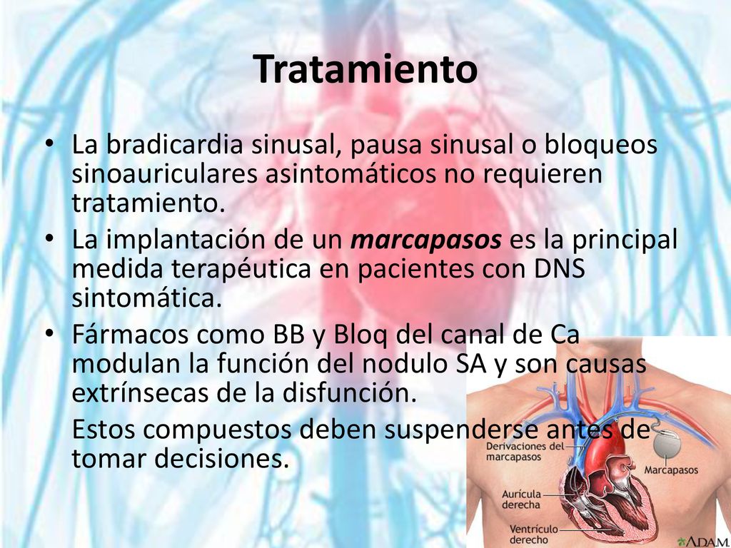 Tratamiento La bradicardia sinusal, pausa sinusal o bloqueos sinoauriculares asintomáticos no requieren tratamiento.