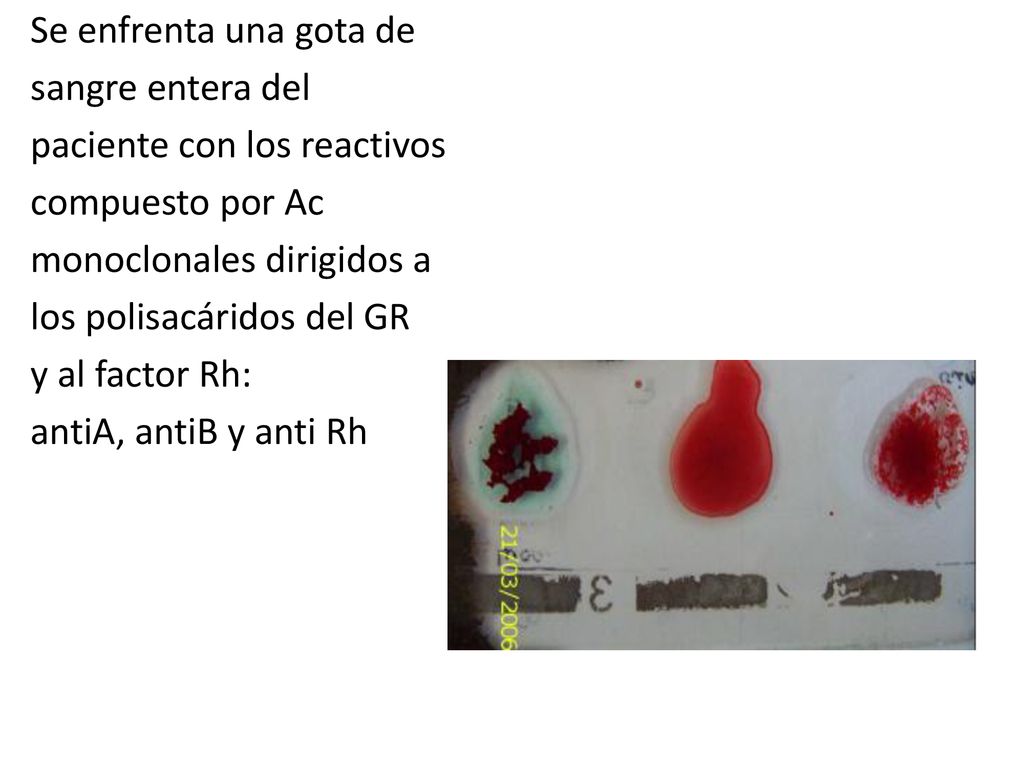 Se enfrenta una gota de sangre entera del paciente con los reactivos compuesto por Ac monoclonales dirigidos a los polisacáridos del GR y al factor Rh: antiA, antiB y anti Rh