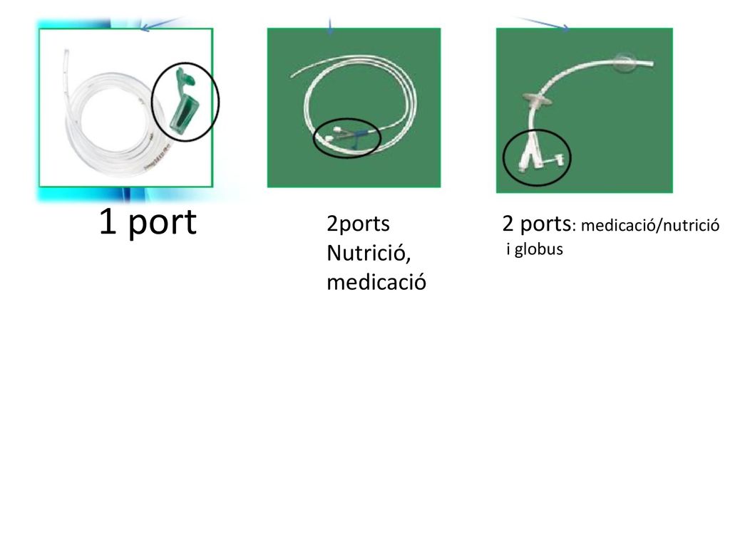 1 port 2ports Nutrició, medicació 2 ports: medicació/nutrició i globus