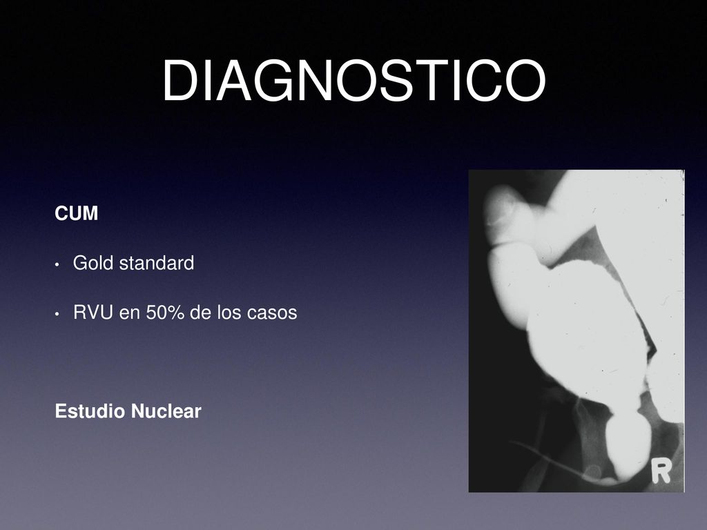 DIAGNOSTICO CUM Gold standard RVU en 50% de los casos Estudio Nuclear