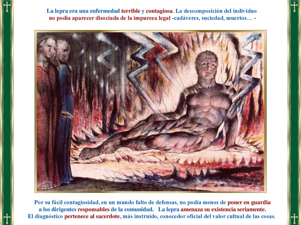 La lepra era una enfermedad terrible y contagiosa
