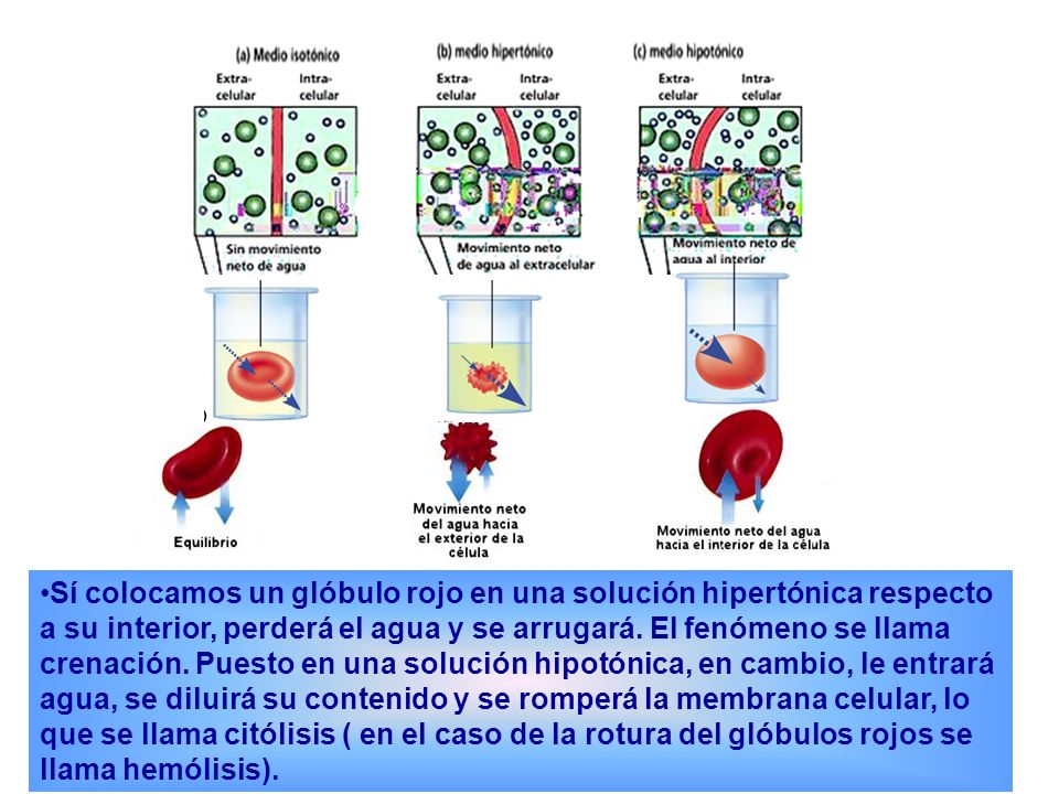 Sí colocamos un glóbulo rojo en una solución hipertónica respecto a su interior, perderá el agua y se arrugará.