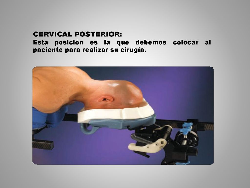 CERVICAL POSTERIOR: Esta posición es la que debemos colocar al paciente para realizar su cirugía.