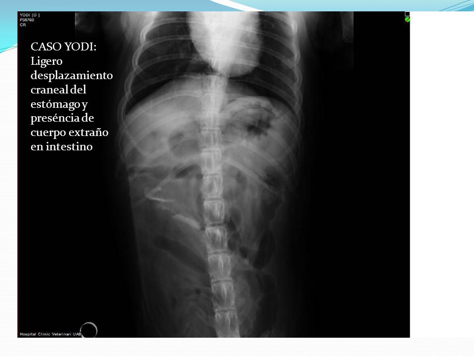 CASO YODI: Ligero desplazamiento craneal del estómago y preséncia de cuerpo extraño en intestino