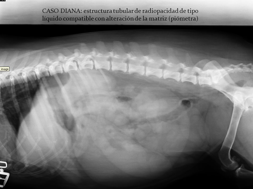 CASO DIANA: estructura tubular de radiopacidad de tipo líquido compatible con alteración de la matriz (piómetra)