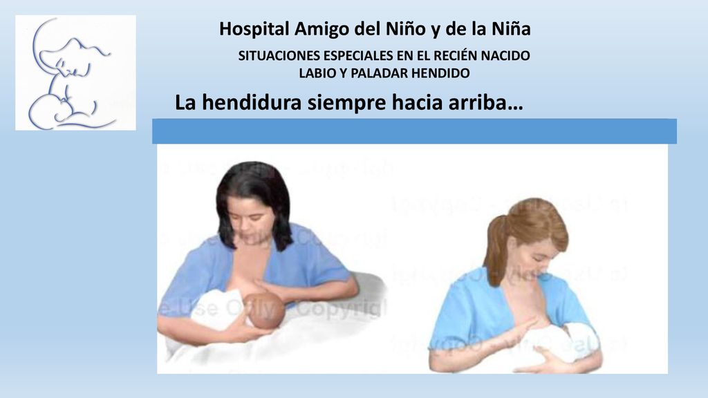 SITUACIONES ESPECIALES EN EL RECIÉN NACIDO LABIO Y PALADAR HENDIDO