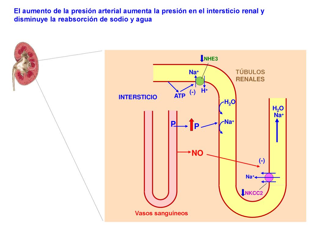 El aumento de la presión arterial aumenta la presión en el intersticio renal y disminuye la reabsorción de sodio y agua