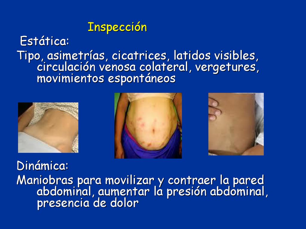 Inspección Estática: Tipo, asimetrías, cicatrices, latidos visibles, circulación venosa colateral, vergetures, movimientos espontáneos.