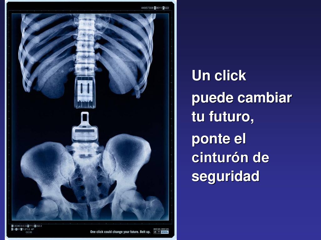 Un click puede cambiar tu futuro, ponte el cinturón de seguridad